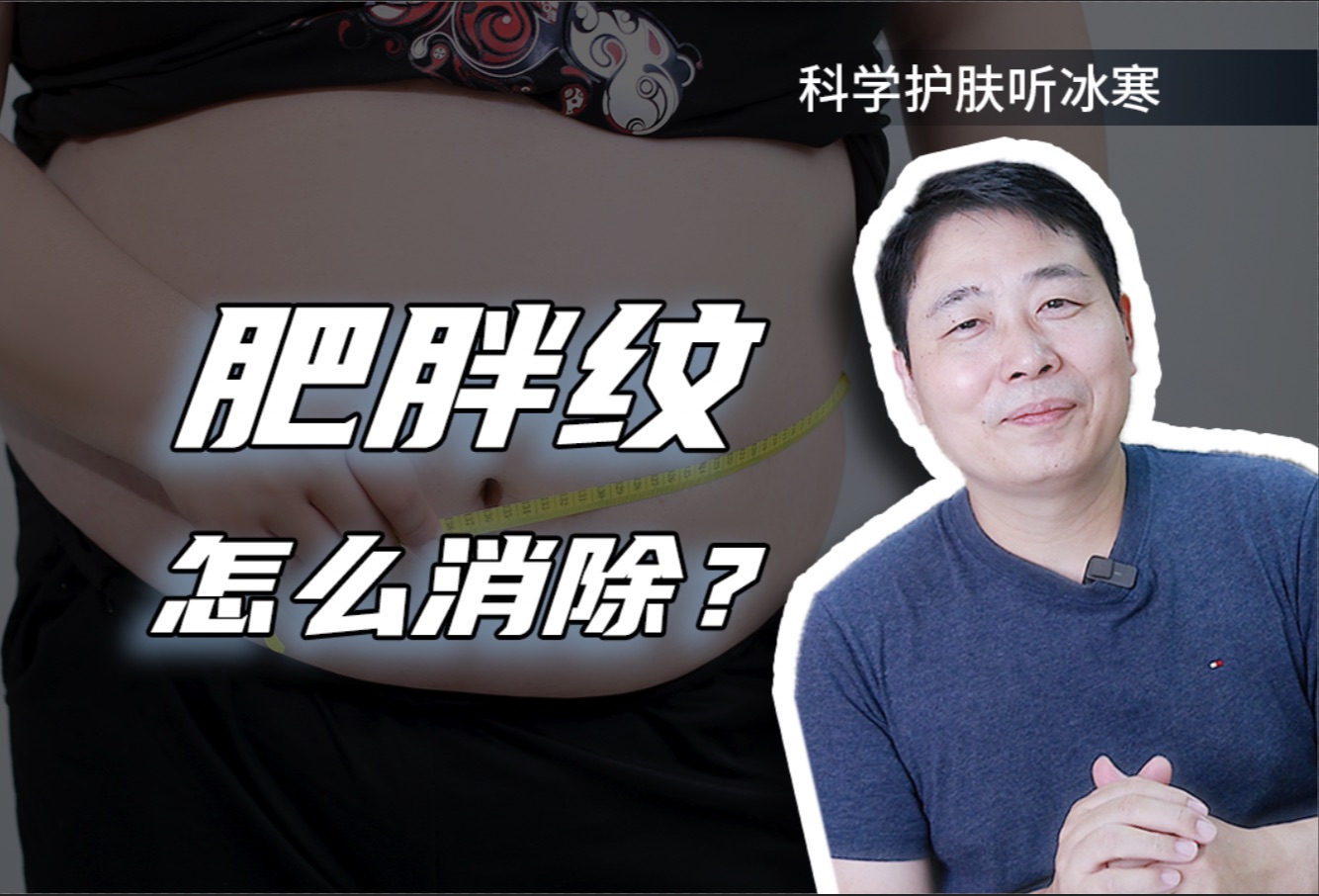 肥胖纹怎么消除?哔哩哔哩bilibili