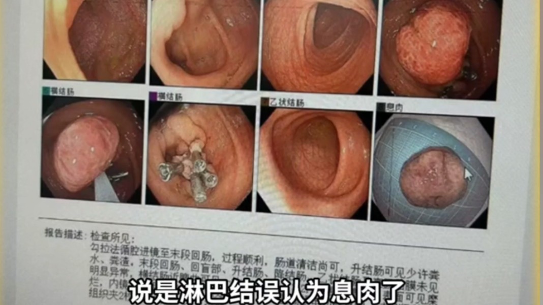 女子称4岁女儿在郑州某医院误诊,手术时将肠子拿出来找了三遍