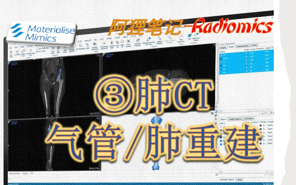 mimics气管肺重建及分割哔哩哔哩bilibili