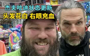 Tải video: 杰夫哈迪状态更新：头发花白，右眼充血！驾照被吊销10年