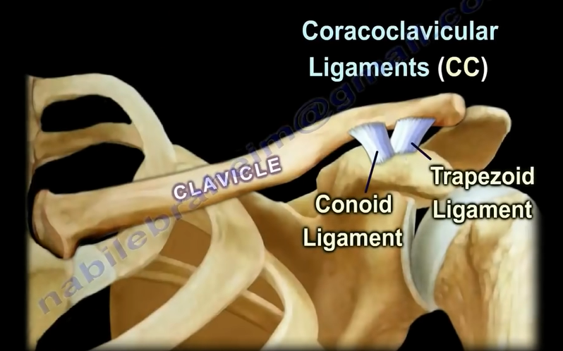 【锁骨骨折】Clavicle Fractures  Everything You Need To Know  Dr. Nabil Ebraheim哔哩哔哩bilibili