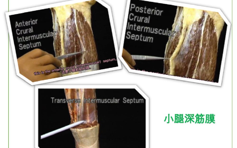 【双语字幕】艾氏解剖学小腿深筋膜(下肢25)哔哩哔哩bilibili