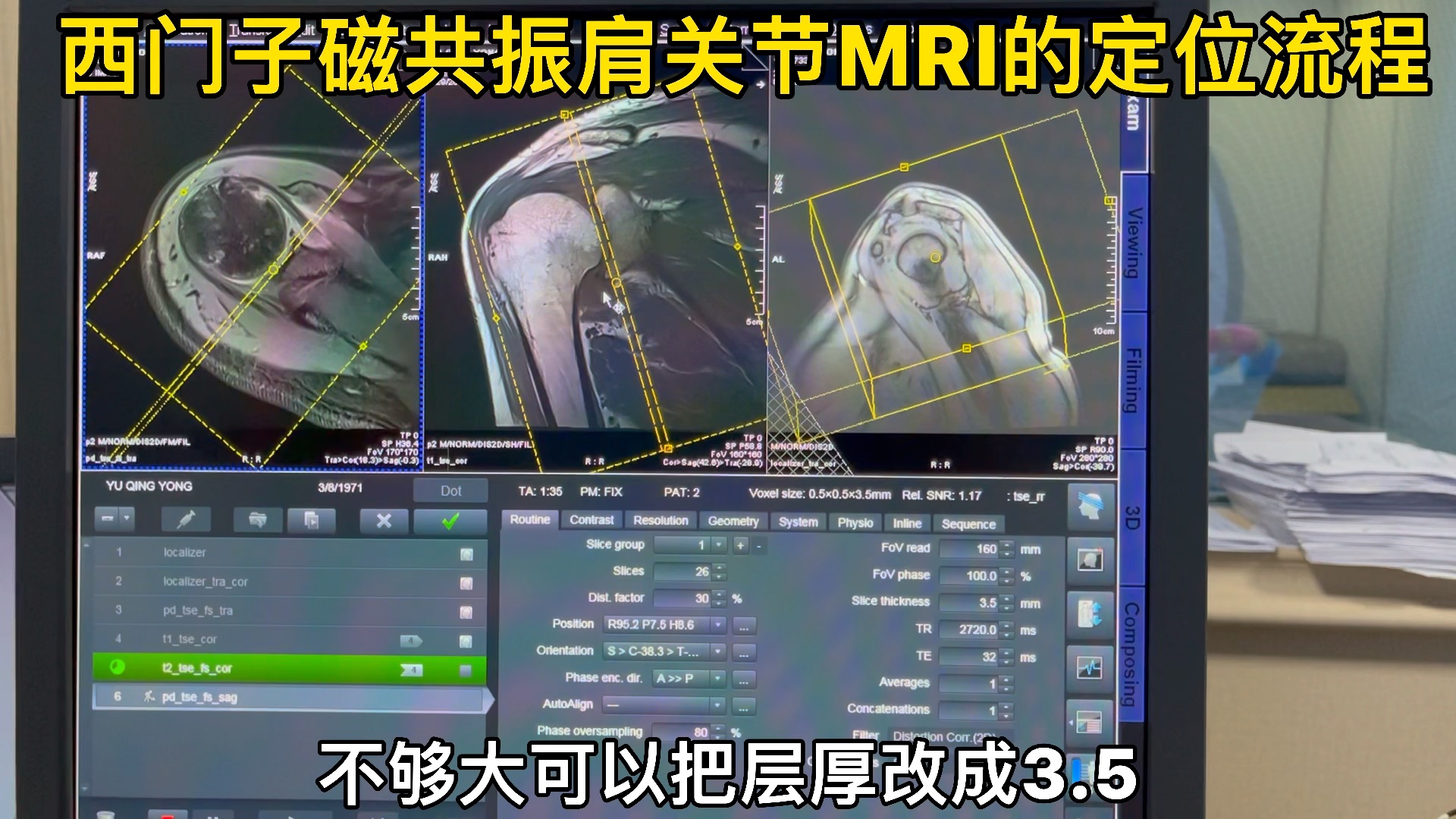 西门子磁共振肩关节MRI的定位流程(新手篇)哔哩哔哩bilibili