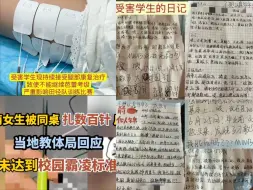 Download Video: 济南女生被被同学扎数百针后续！当地教体局回应：未达到校园霸凌标准。七八厘米的针连把都扎进去了，你告诉我未达到霸凌标准？