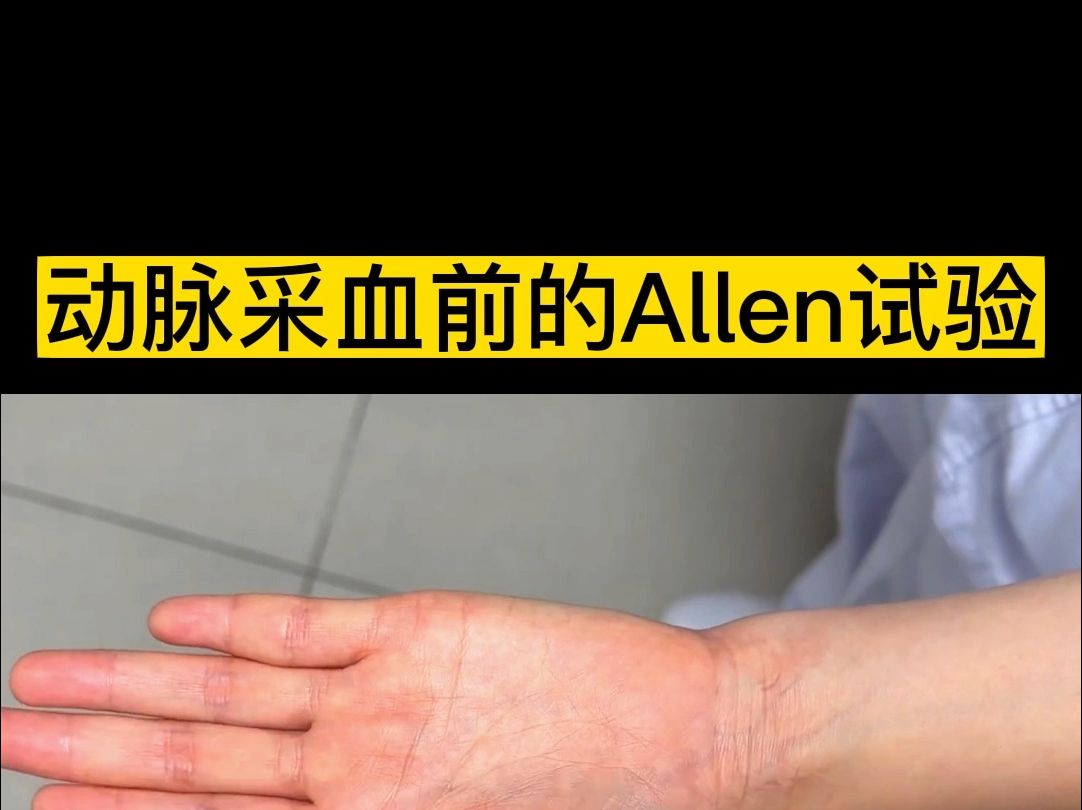 动脉采血前的Allen试验,你有在做吗?哔哩哔哩bilibili