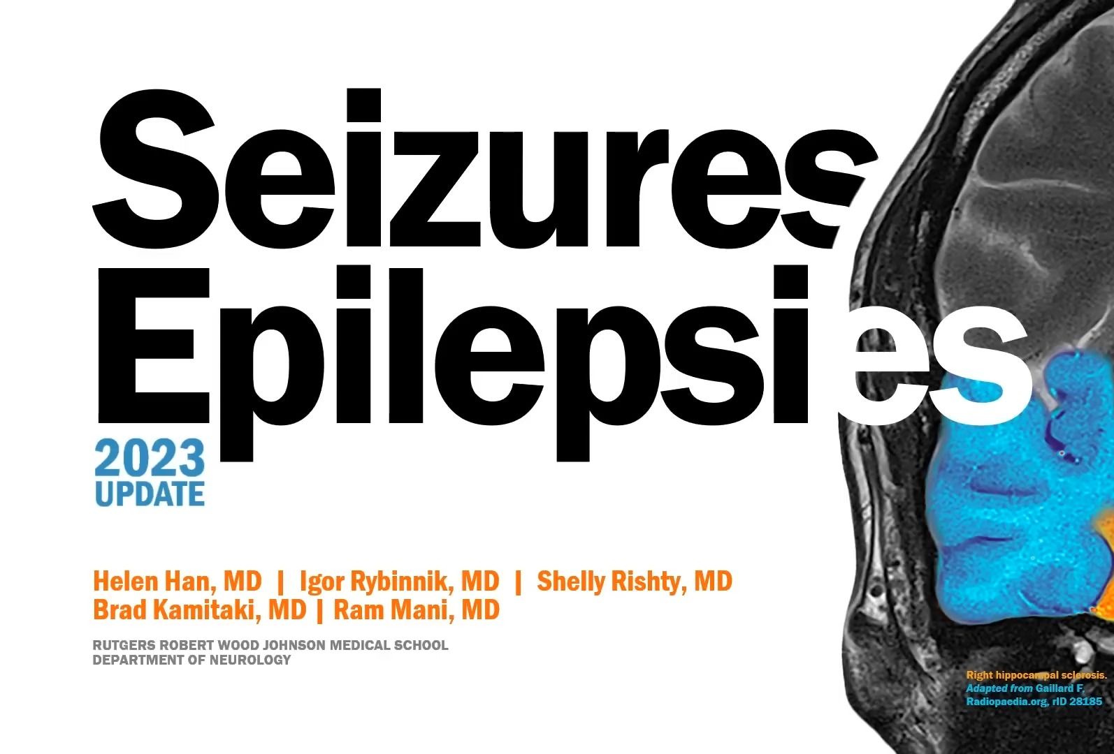 癫痫发作与癫痫临床、影像、治疗全面介绍Seizures and Epilepsies 2023哔哩哔哩bilibili