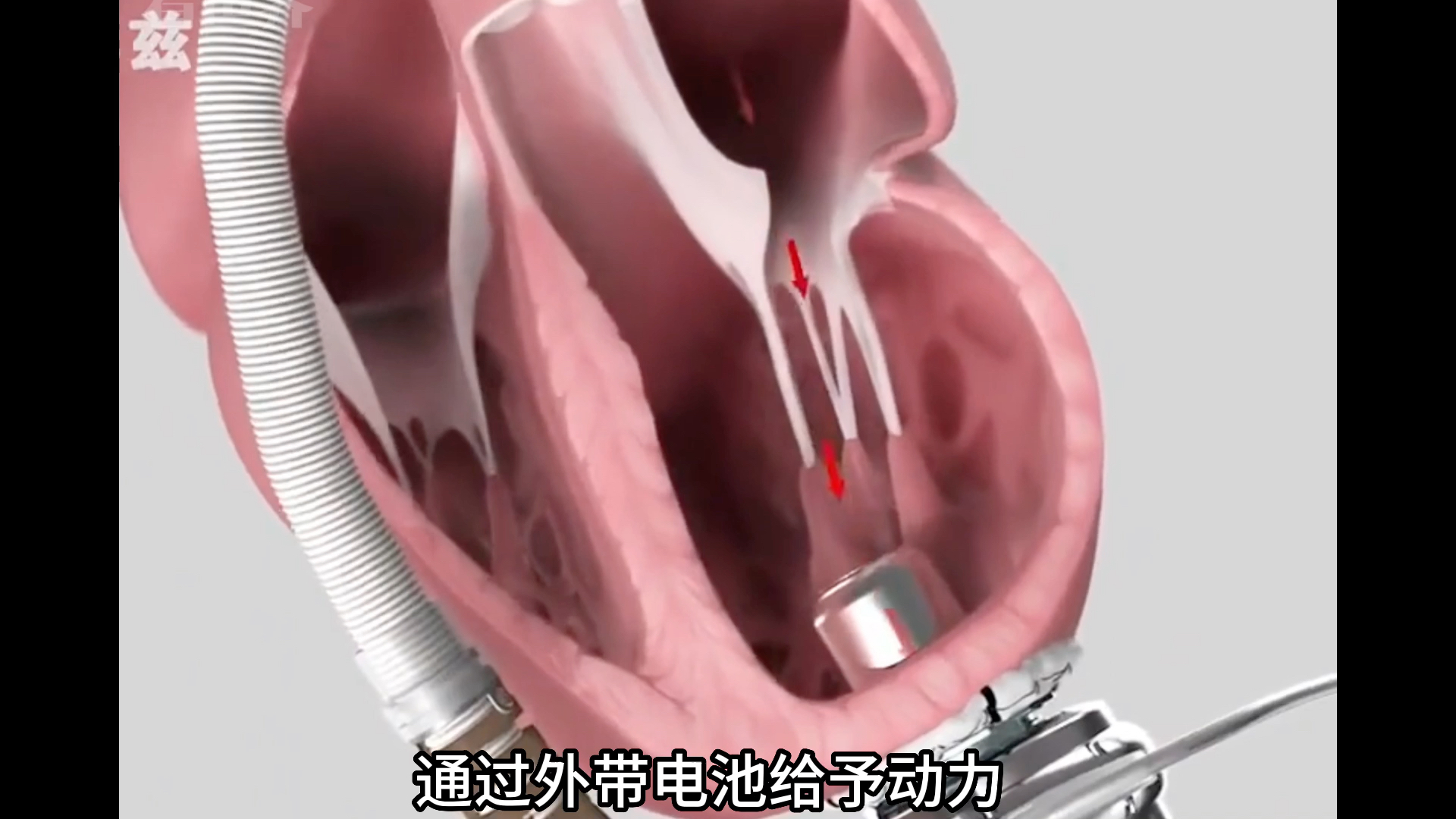 中国第一颗人工心脏