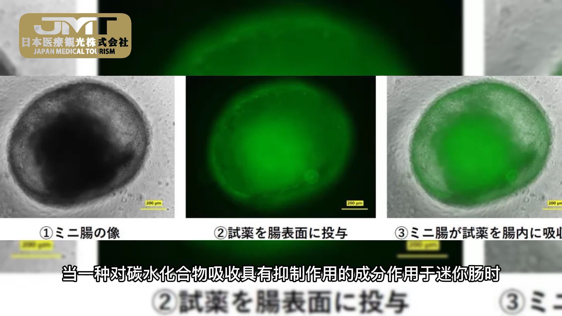 [图]日本干细胞——iPS细胞制成的迷你肠吸收了三大营养素