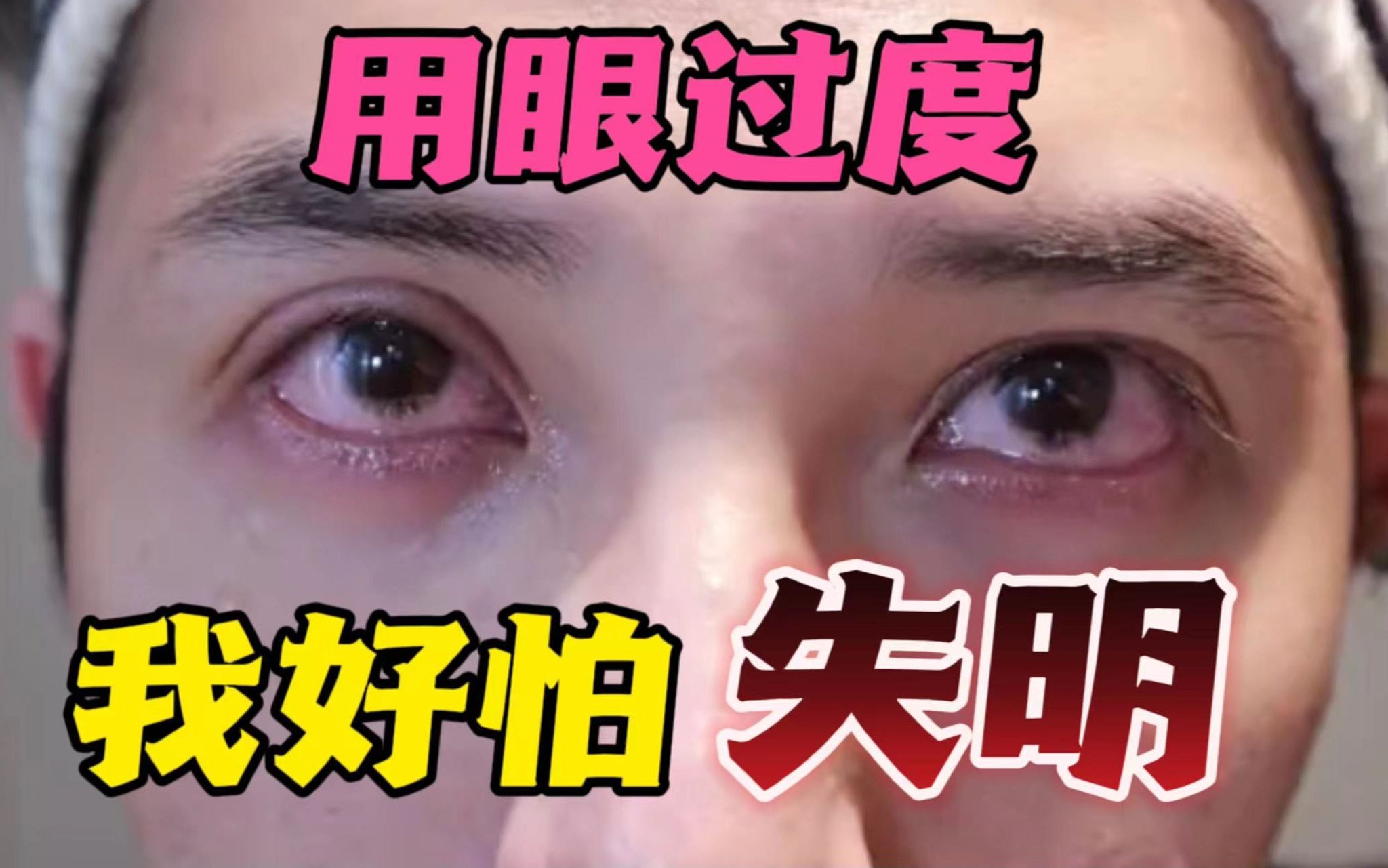 [图]以防变瞎!每天这样来一次，缓解眼部疲劳 红血丝干涩黑眼圈女朋友都夸我会买。