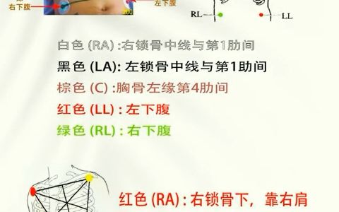 十二导联心电图位置,看完就能记住!