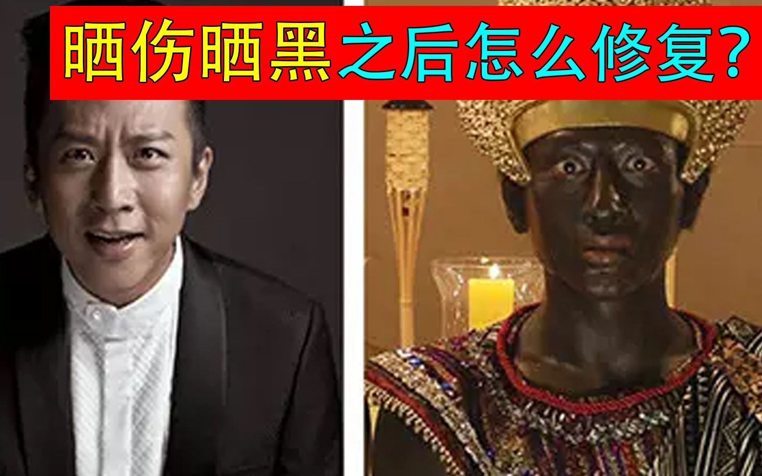 夏天晒黑晒伤怎么办别怕这些小方法教你如何晒后修复