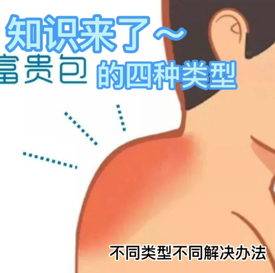 富贵包的四种类型!看看你属于那一类吧?哔哩哔哩bilibili