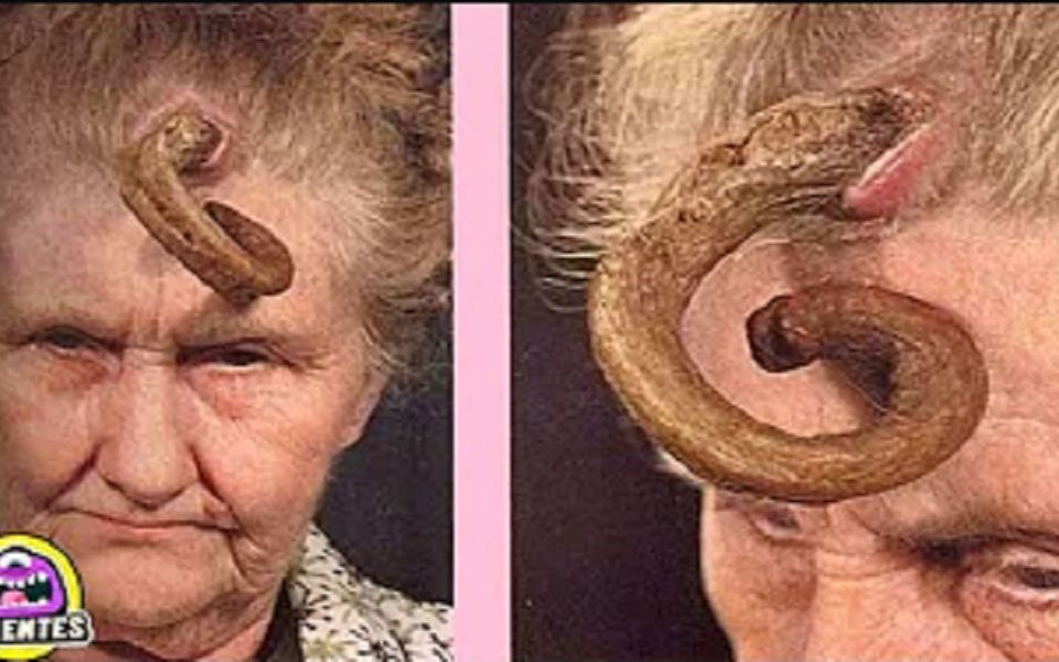 他们的头上竟长出犄角被当地人视作恶魔的化身