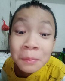 这种呆傻的孩子长得都一样