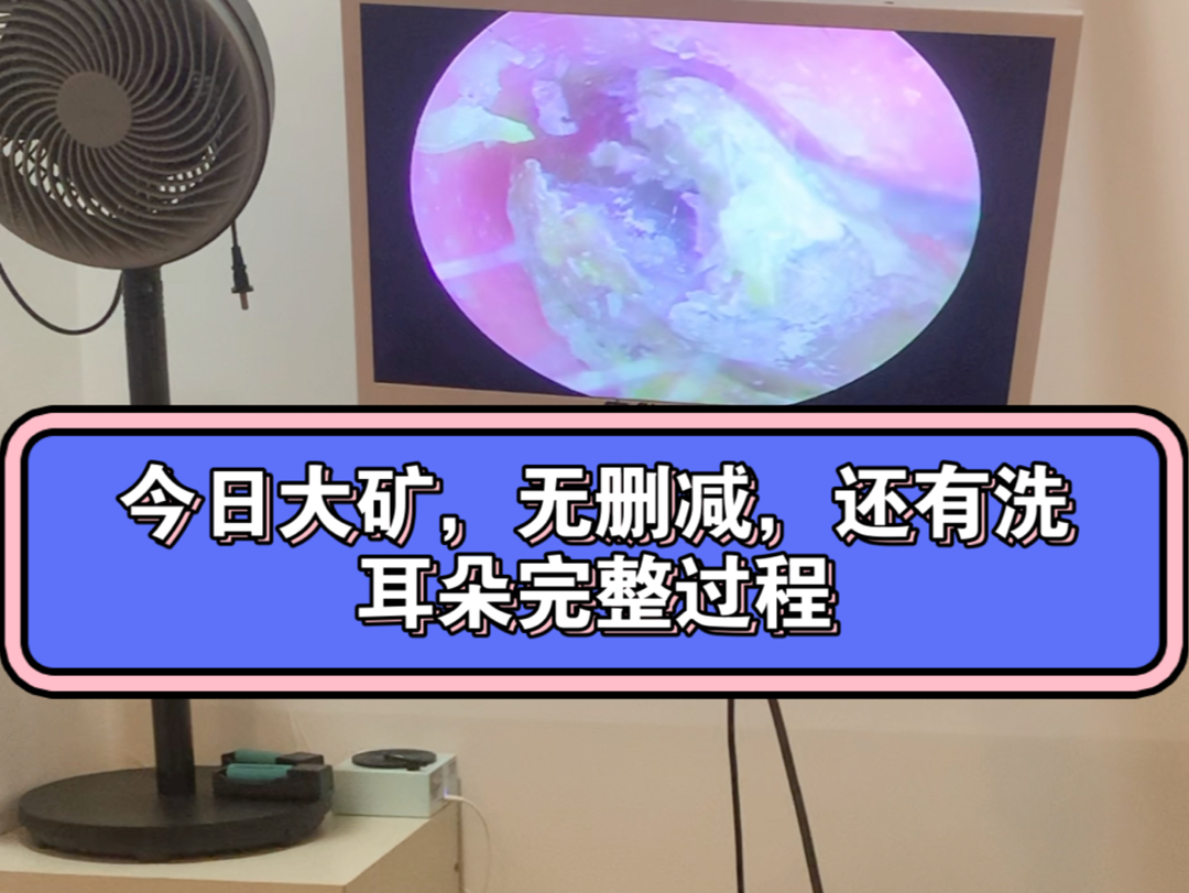 深圳可视采耳~采的很干净,无删减,洗耳全过程都拍了哔哩哔哩bilibili