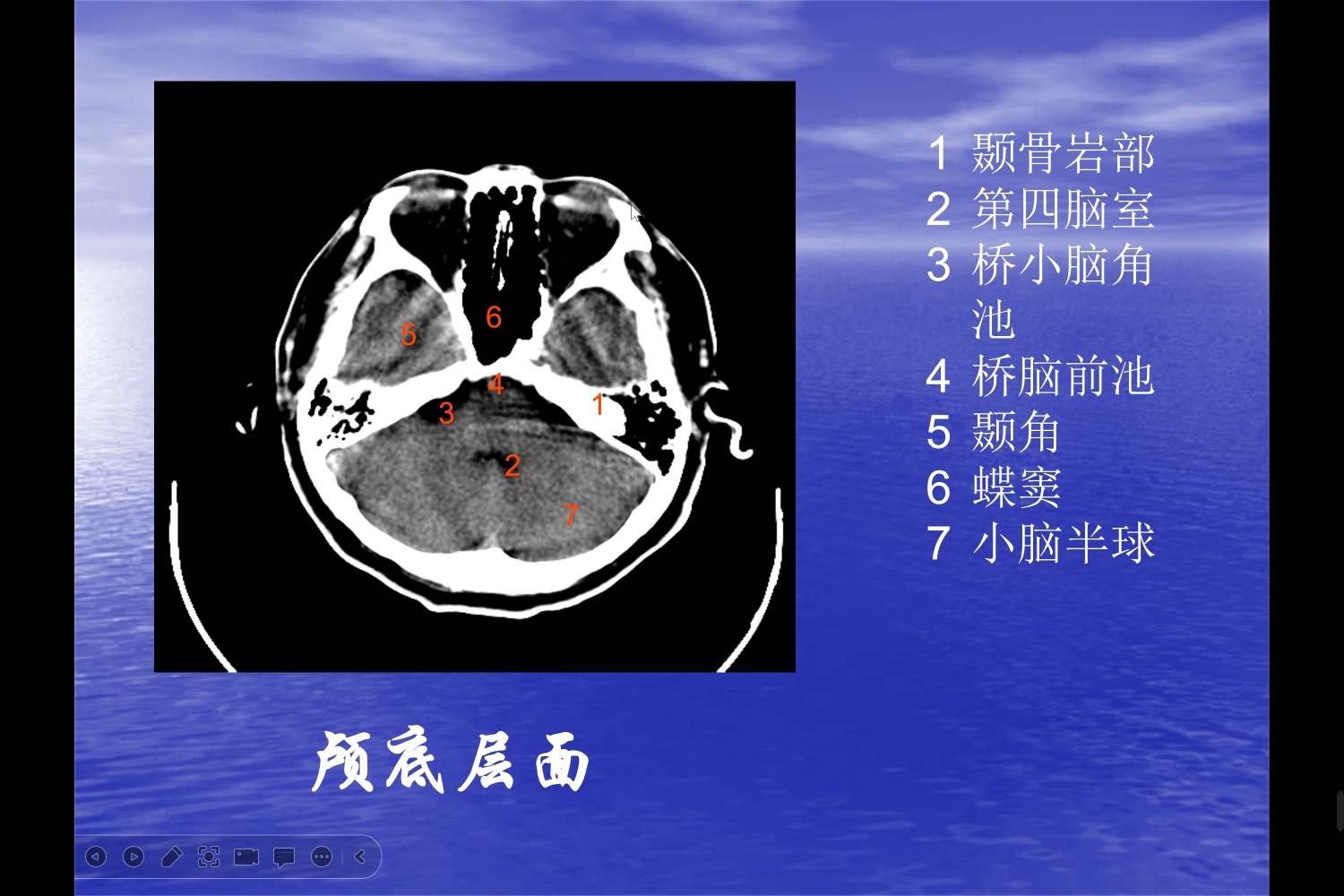 学习正常头颅CT哔哩哔哩bilibili