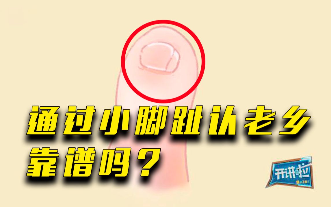 [图]小脚趾盖分瓣的，祖上都来自山西省洪洞县？