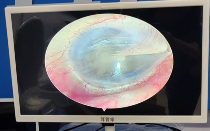 c01超高清可视采耳仪器专业可视采仪器/设备可视采耳免费培训户外专用