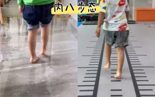 Tải video: 4岁半男生内八步态第一阶段复查情况，家长满意，期待下一阶段