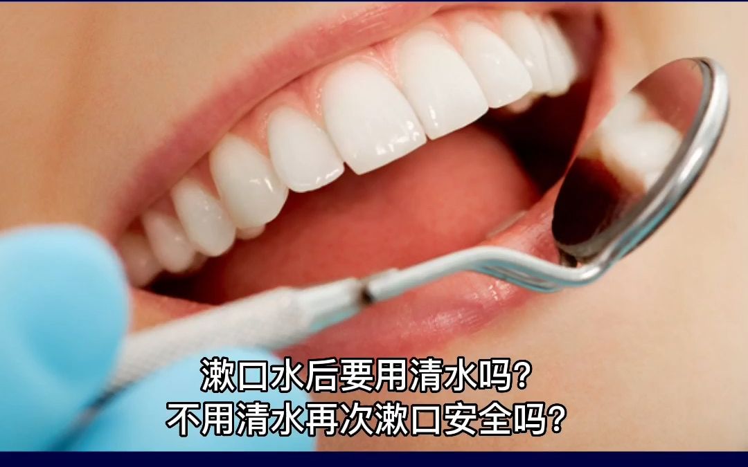 漱口水代加工厂家科普:漱口水漱完要用清水漱口吗?哔哩哔哩bilibili