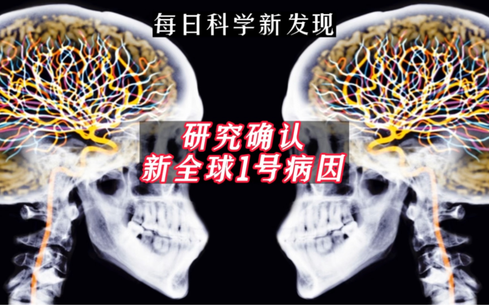 【每日科学新发现】柳叶刀子刊:研究确认新全球1号病因哔哩哔哩bilibili