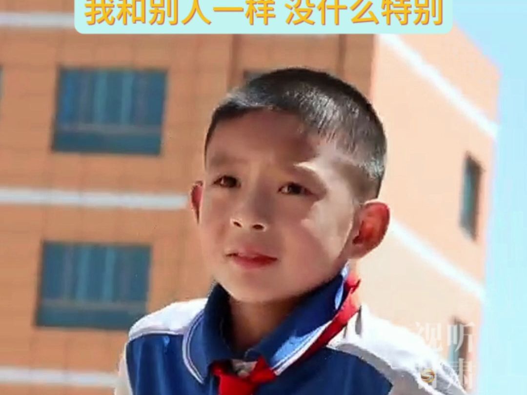 独腿少年张启航:我和别人都一样,没什么特别
