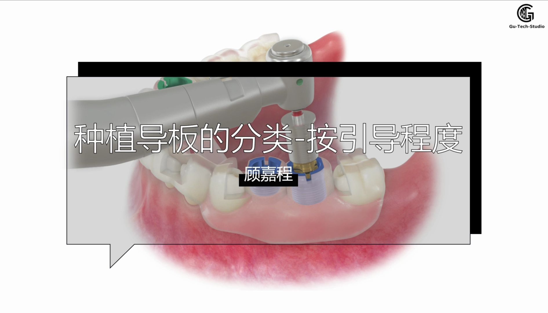 40-种植导板的分类-按引导程度