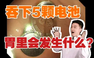 Descargar video: 【慎入】吞下5块电池，胃里会发生什么变化！？？