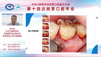 2022民营口腔年会之牙周专场(多学科牙周护理)1哔哩哔哩bilibili