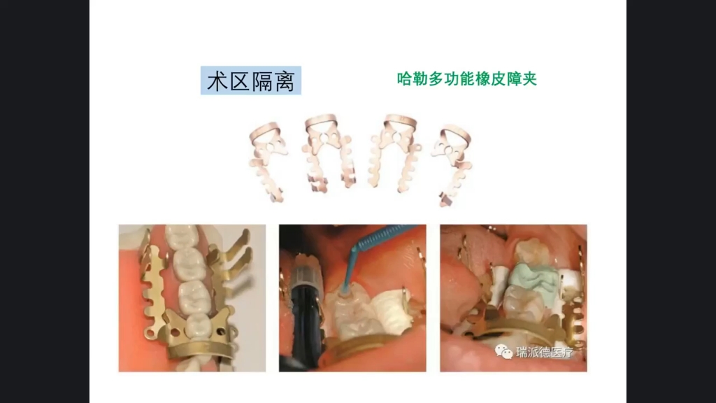 2023华西王博根管治疗标准化——根管治疗标准化流程之二:术区隔离哔哩哔哩bilibili