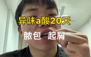 Download Video: 异维a酸第20天，还是整脸脓包和起屑，总是低着头走路。