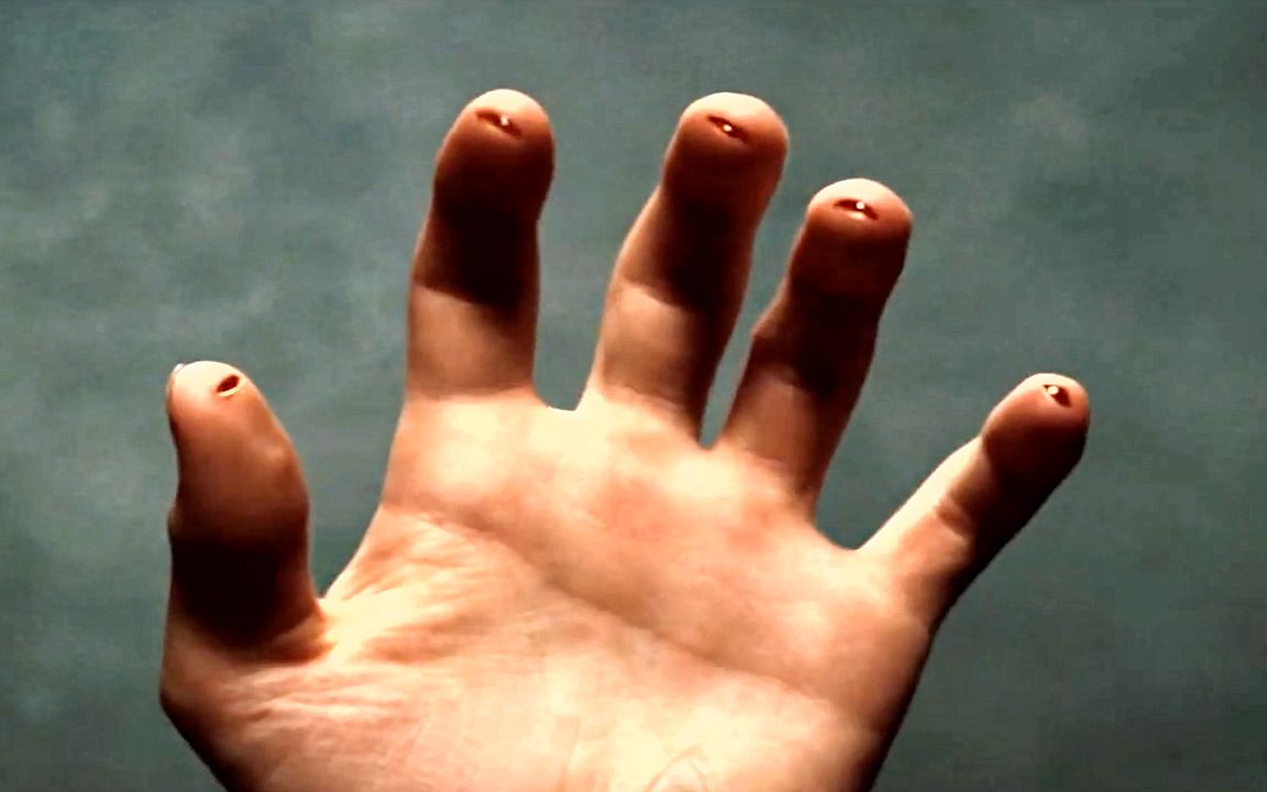 小伙一觉醒来身体发生变化手指尖出现了五道血口