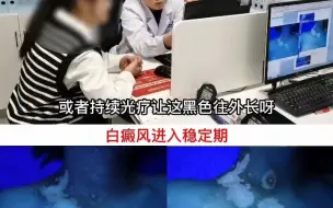 Download Video: 兰州专治白癜风的医生：白癜风治疗控制-兰州中研