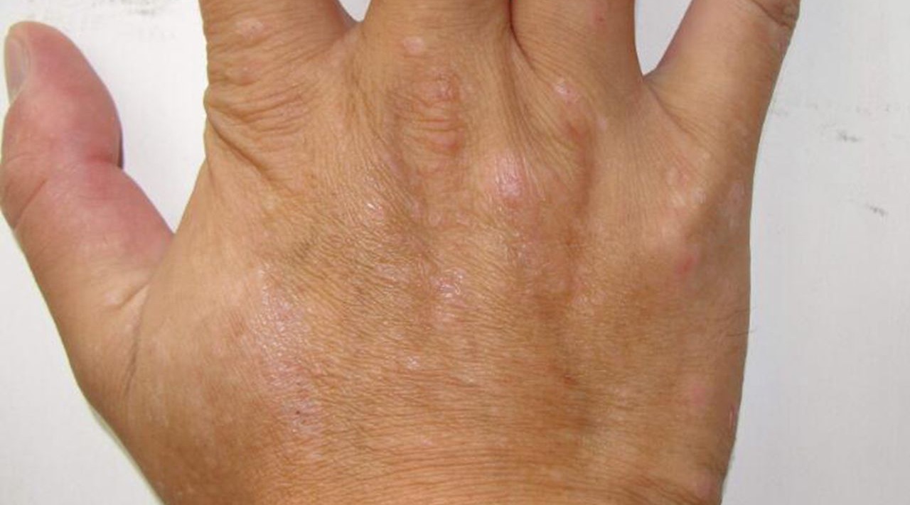 手背有皱纹怎么办?其实一点废物就可以搞定,让双手白嫩又光滑