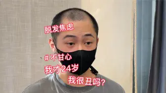 Descargar video: 要知道我曾经也有很多头发