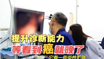 等看到癌就晚了！医生告诫学生：从细微处发现问题并进行科学分析