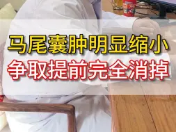 Télécharger la video: 马尾囊肿明显缩小 争取提前完全消掉