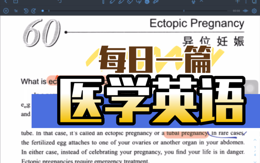 每日一篇医学英语|ectopic pregnancy异位妊娠 (1)哔哩哔哩bilibili