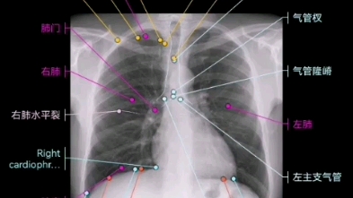 [图]影像解剖图谱 胸片（X-Ray）+肺部解剖插画