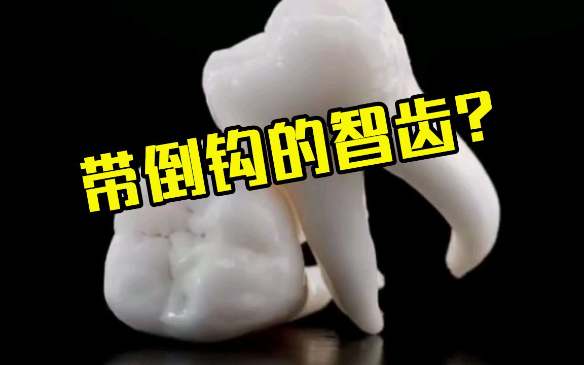 你见过带倒钩的智齿吗你的智齿长啥样