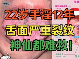 Download Video: 22岁小伙子，手淫12年，舌面严重裂纹，再不戒手淫，神仙都难救！！