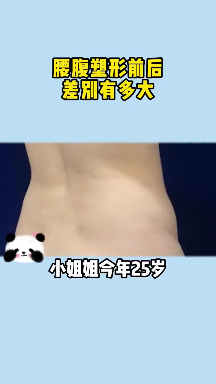 [图]25岁小姑娘腰腹吸脂：身上肉肉的是什么体验。