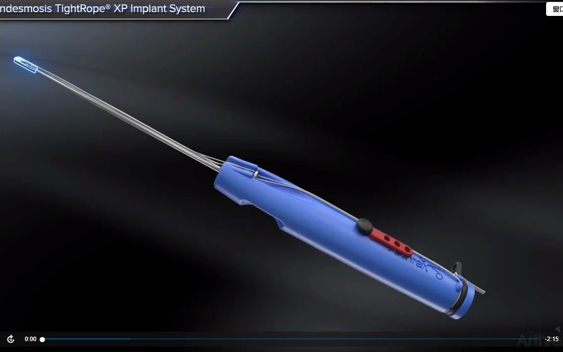 [图]Syndesmosis TightRope® XP Implant System