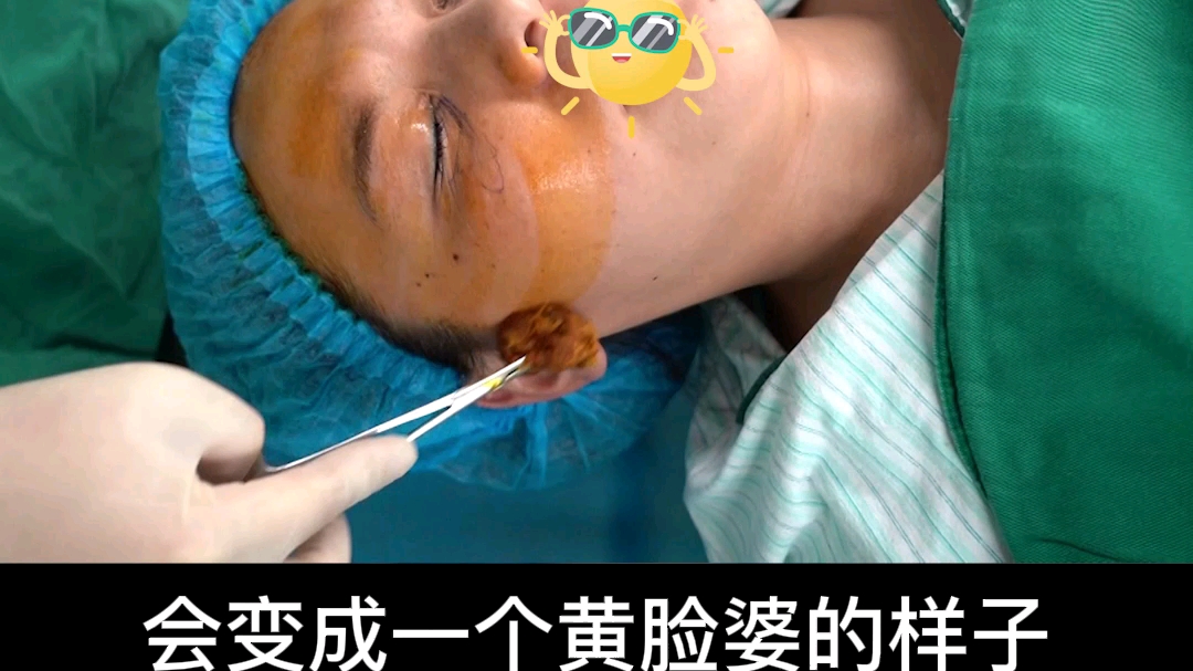 碘伏消毒面部发黄如何变白