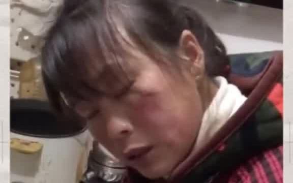 如果一个巴掌能赚35W,请把我的头打歪.张若宇张若宇的卑微生活搞笑沙雕日常抖音干货哔哩哔哩bilibili