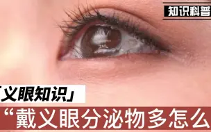 下载视频: 戴义眼分泌物多怎么办？