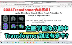 Descargar video: 2024论文最佳创新点！Swin-Unet：基于Transformer的医学图像分割实战，论文详解+源码复现，研究生必看！