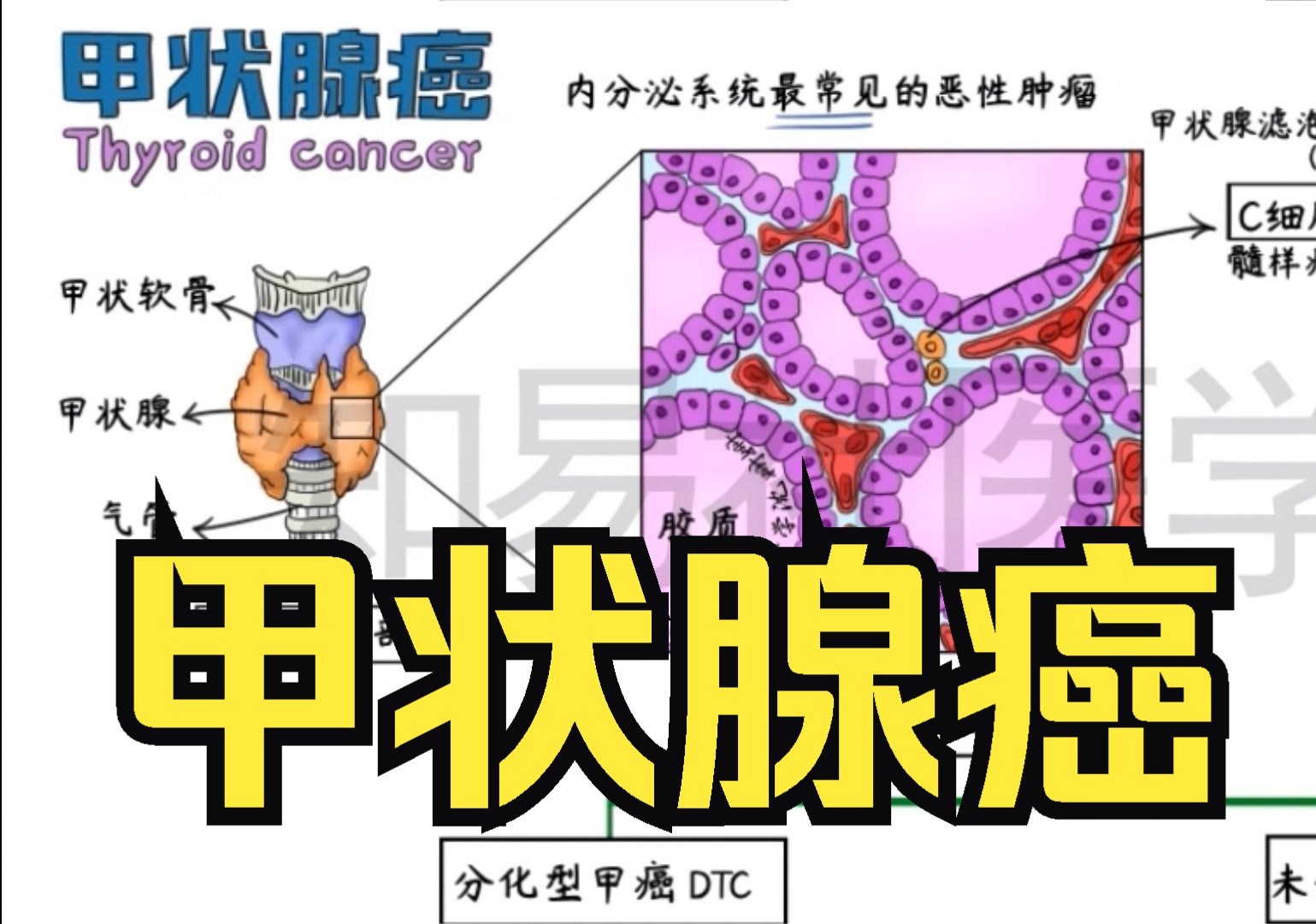 绘画内科 甲状腺癌哔哩哔哩bilibili