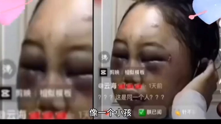 女孩为了嫁给黑人留学生不顾父母和亲戚反对,婚后经常受到家暴.