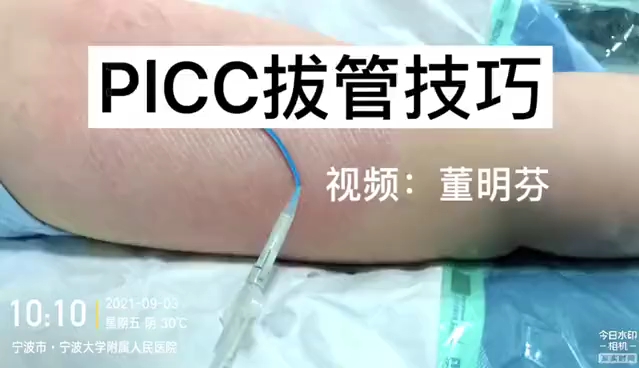 PICC拔管技巧哔哩哔哩bilibili